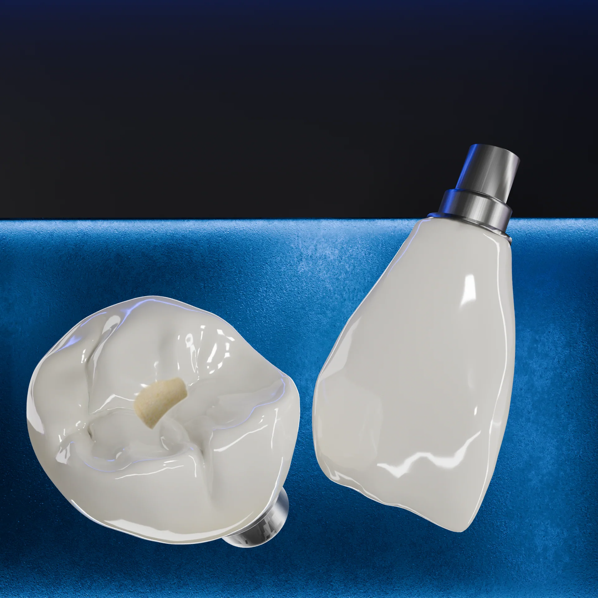 Implant Screw-Retained Crown